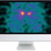 arrs clinical case based review of nuclear medicine 2019 medical video courses 368468 540x