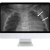 arrs clinical case based review of pediatric imaging 2019 medical video courses 160297 720x