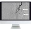 arrs clinical case based review of vascular and interventional imaging 2019 medical video courses 427241 720x