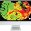 arrs code stroke what the radiologist needs to know in the changing landscape of acute ischemic stroke 2019 medical video courses 903315 540x