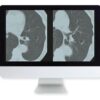 arrs lung cancer screening a comprehensive guide online course 2015 medical video courses 145970 540x