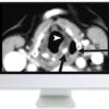 arrs thyroid cancer therapy go high go low or go home 2020 medical video courses 301385 540x 1