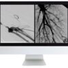 arrs vascular and interventional radiology review 2016 medical video courses 677565 540x