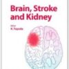 brain stroke and kidney 215x3001 1 176x246 1