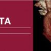 classic lectures in cardiac cta 2018 videos medical video courses 774033 540x 1