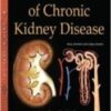 essentials of chronic kidney disease 209x3001 1 176x253 1