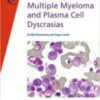 fast facts multiple myeloma and plasma cell dyscrasias 212x3001 1 176x249 1