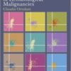 flow cytometry of hematological malignancies 222x3001 1 176x238 1