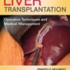 liver transplantation operative techniques and medical management high quality pdf 2021 176x234 1