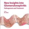 new insights into glomerulonephritis pathogenesis and treatment 215x3001 1 176x246 1