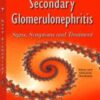 primary and secondary glomerulonephritis signs symptoms and treatment 197x3001 1 176x268 1