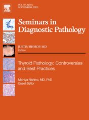 Each issue of  Seminars in Diagnostic Pathology  offers current, authoritative reviews of topics in diagnostic anatomic pathology.