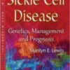 sickle cell disease genetics management and prognosis 186x3001 1 176x284 1