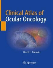 Clinical Atlas of Ocular Oncology 2022 Original pdf