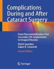 Complications During and After Cataract Surgery From Phacoemulsification Over Secondary IOL Implantation to Dropped Nucleus 2022 original pdf