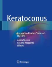 Keratoconus Current and Future State-of-the-Art 2022 original pdf