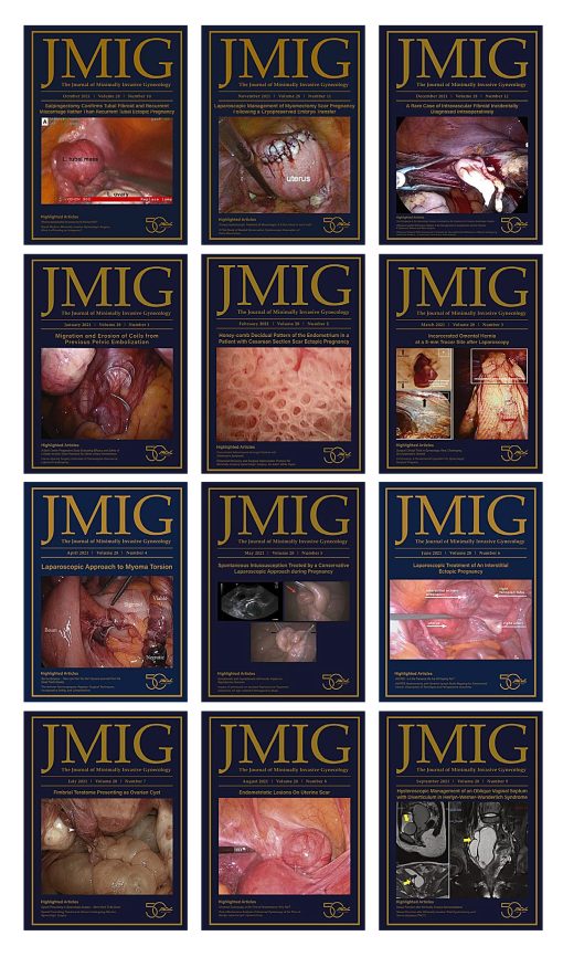 journal of minimally invasive gynecology 2021 510x866 1