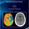 a practical guide to comprehensive stroke care meeting population needs 199x3001 1