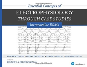 essential concepts of electrophysiology through case studies intracardiac egms 300x2321 1