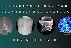 Neuroradiology and Interventional Radiology 2020