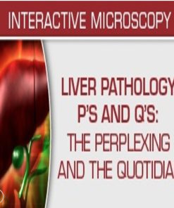 USCAP Liver Pathology P’s and Q’s