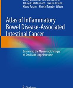 Atlas of Inflammatory Bowel Disease-Associated Intestinal Cancer