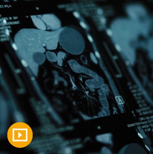 UCSF Abdominal and Pelvic Imaging 2023