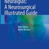 Trigeminal Neuralgias