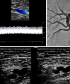 2023 ASE Registered Physician in Vascular Interpretation