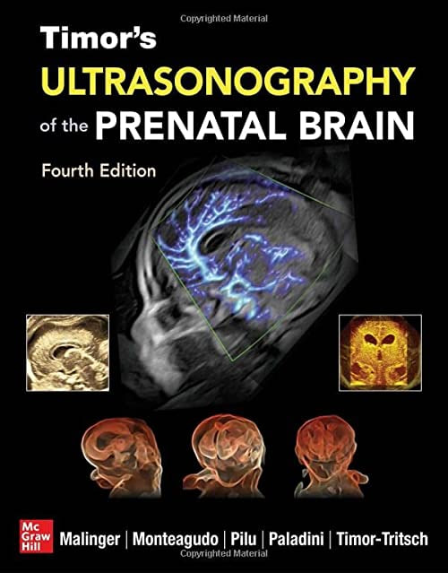 Timor’s Ultrasonography of the Prenatal Brain