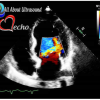 Adult Echocardiography – Test & Learn Registry Review Quiz – AllAboutUltrasound