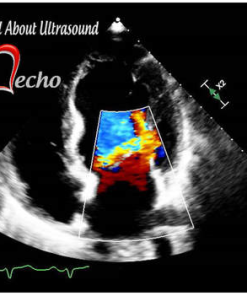 Adult Echocardiography – Test & Learn Registry Review Quiz – AllAboutUltrasound