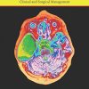 Arachnoid Cysts: Clinical and Surgical Management