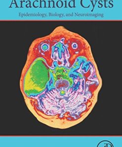 Arachnoid Cysts: Epidemiology, Biology, and Neuroimaging