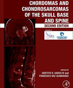 Chordomas and Chondrosarcomas of the Skull Base and Spine, Second Edition