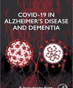 COVID-19 in Alzheimer’s Disease and Dementia