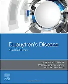 Dupuytren’s Disease: A Scientific Review ()