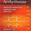 Electrophysiology of Arrhythmias: Practical Images for Diagnosis and Ablation ()