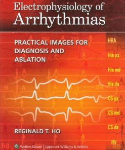 Electrophysiology of Arrhythmias: Practical Images for Diagnosis and Ablation ()