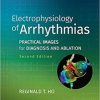 Electrophysiology of Arrhythmias: Practical Images for Diagnosis and Ablation, 2nd Edition