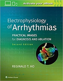 Electrophysiology of Arrhythmias: Practical Images for Diagnosis and Ablation, 2nd Edition