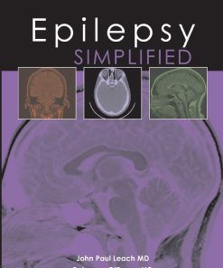 Epilepsy Simplified ()