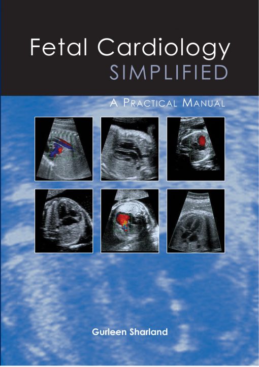 Fetal Cardiology Simplified ()