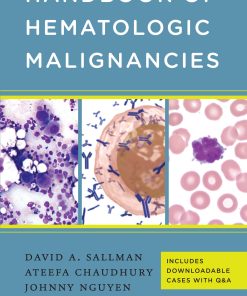 Handbook of Hematologic Malignancies ()