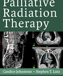 Handbook of Palliative Radiation Therapy