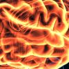 Harvard Neurology for the Non-Neurologist 2023