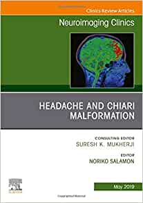 Headache and Chiari Malformation, An Issue of Neuroimaging Clinics of North America (Volume 29-2) (The Clinics: Radiology, Volume 29-2)