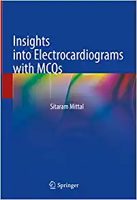 Insights into Electrocardiograms with MCQs