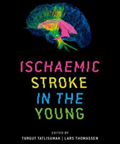 Ischaemic Stroke in the Young