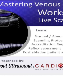 Mastering Venous Insufficiency – AllAboutUltrasound